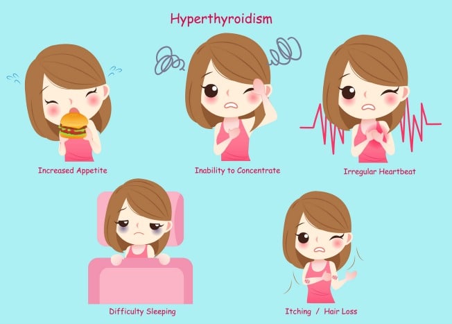 Hyperthyroidism - The Cause, Symptoms, Labs and First Steps to Take 