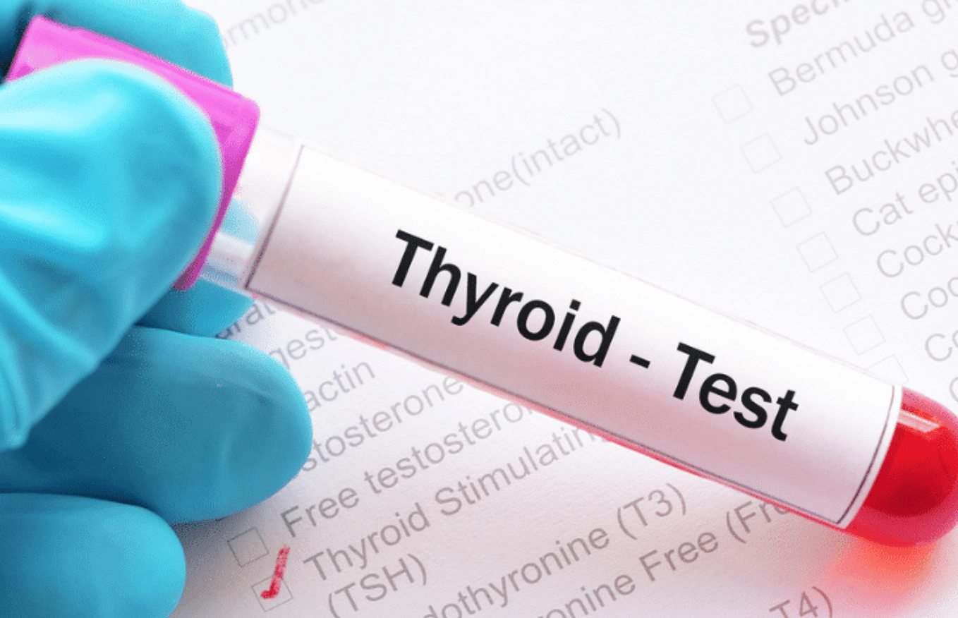 Hyperthyroidism - The Cause, Symptoms, Labs and First Steps to Take